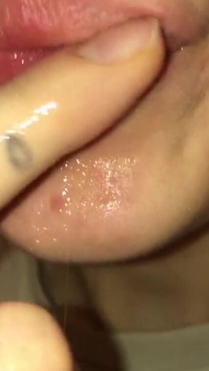 Endosccope deep into mouth. sluts with braces gags. Uvula bdsm