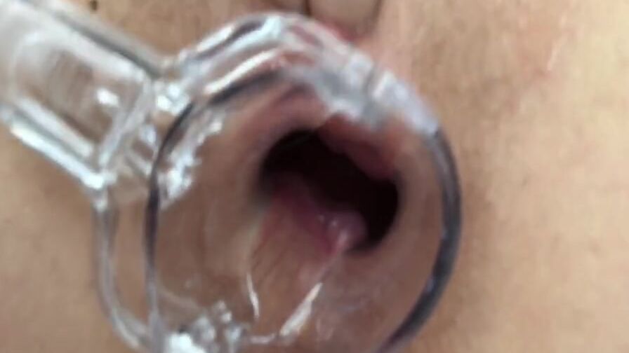 speculum inside this filthy hoe her butt